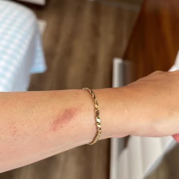 Monalisa Sağlıklı Güzellik Sincan Hijyen Ve Profesyonellik Sorunları