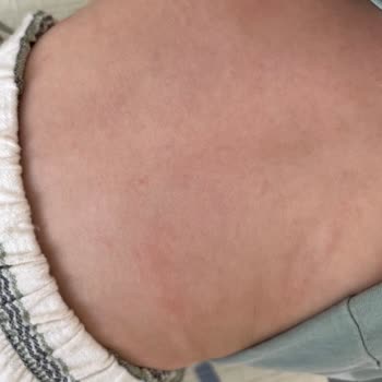 Hipp Milk Lotion Sensitive ruiniert Babyhaut trotz natürlicher Inhaltsstoffe