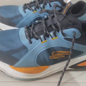 Skechers Ayakkabıda İki Ayda Yırtılma Ve İlgisizlik