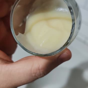 Bozanın Ekşimiş Kokusu Hamile Eşimi Tehlikeye Attı