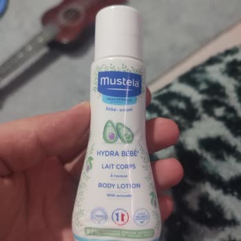 Bebek Losyonu Ciltte Tahrişe Neden Oldu