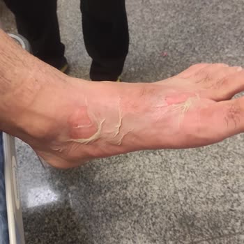 Homend Çay Makinesi Güvenlik Sorunu