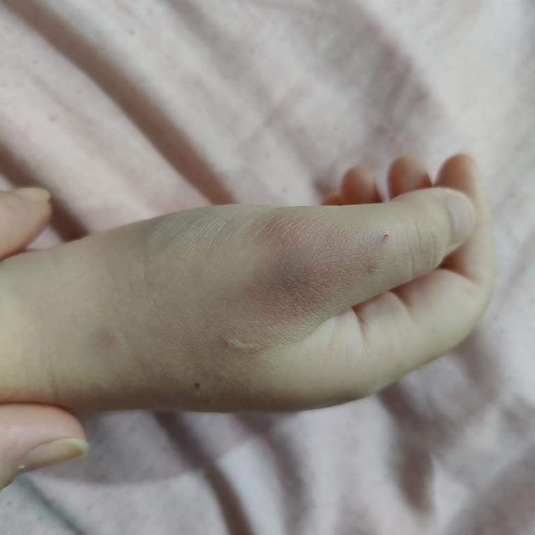 Hastanede Hemşirelerin Yetersizliği Ve Aşağılama