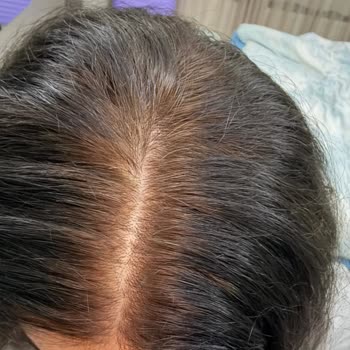 Loreal Excellence Saç Boyası Beklentileri Karşılamıyor