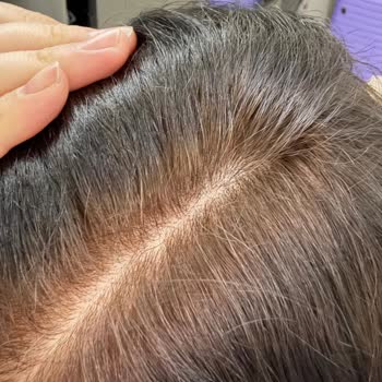 Loreal Excellence Saç Boyası Beklentileri Karşılamıyor