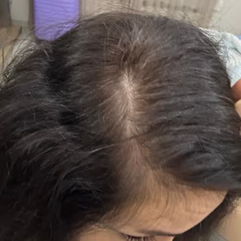 Loreal Excellence Saç Boyası Beklentileri Karşılamıyor