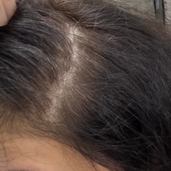 Loreal Excellence Saç Boyası Beklentileri Karşılamıyor