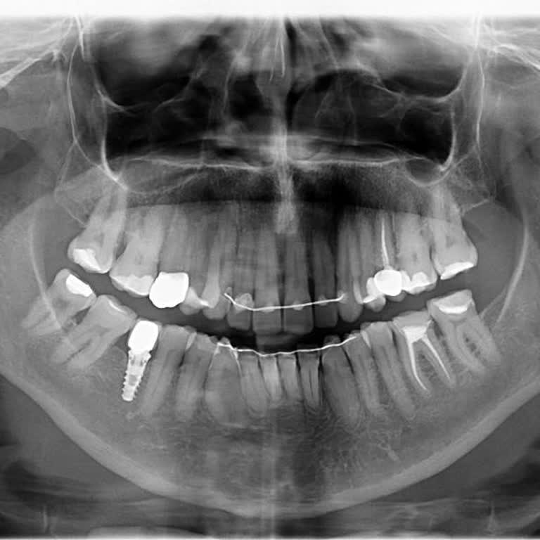 İstanbul Diş Hekimleri Odası Ortodonti Tedavisinde Hayal Kırıklığı