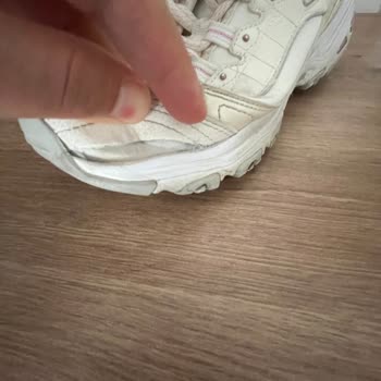 Skechers D’lites Sneakers Tore Within 2 Years – Warranty Claim Denied