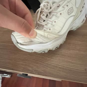Skechers D’lites Sneakers Tore Within 2 Years – Warranty Claim Denied