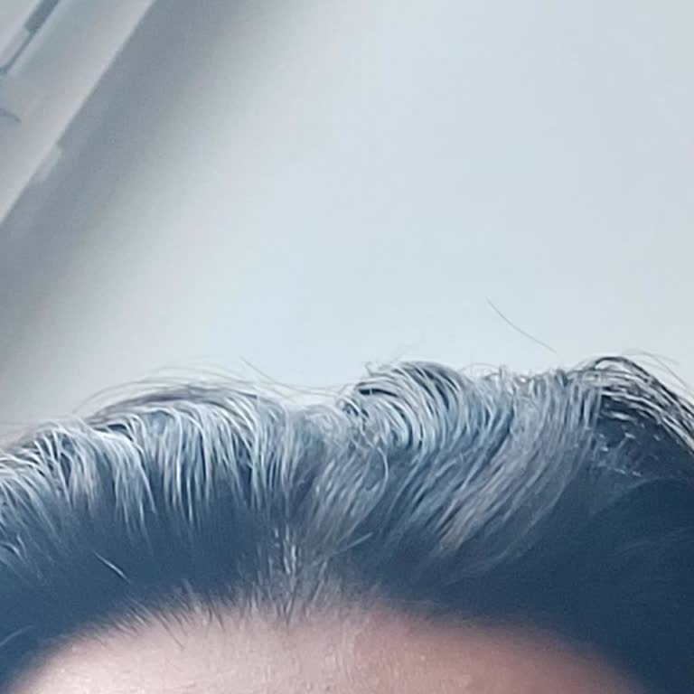 La Roche Posay Toner and Cleanser Caused Redness and Acne