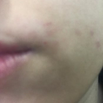 Hijyen Eksikliği Ve Kaba Davranışla Karşılaştım