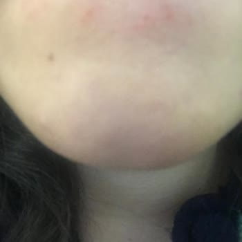 Hijyen Eksikliği Ve Kaba Davranışla Karşılaştım