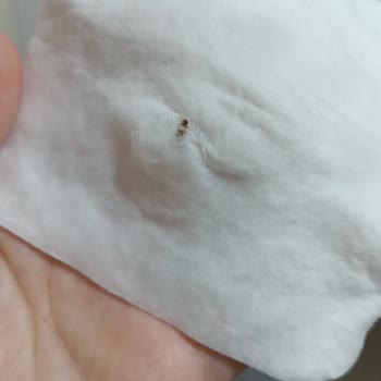 Bebek Ürününde Böcek Şoku Ve İlgisiz Müşteri Hizmeti