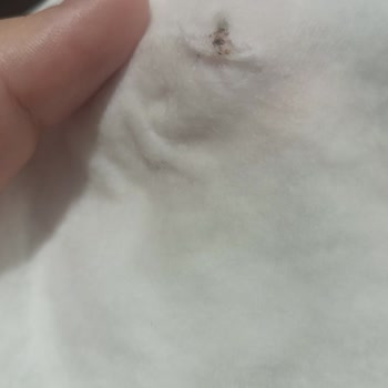 Bebek Ürününde Böcek Şoku Ve İlgisiz Müşteri Hizmeti