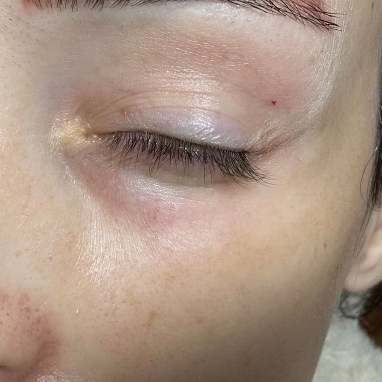 Nouvelle Vie Güzellik Merkezi Microblading İşleminde Renk Sorunu Ve Mağduriyet