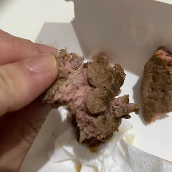 Çiğ Hamburger Ve Çocuk Sağlığına Tehdit