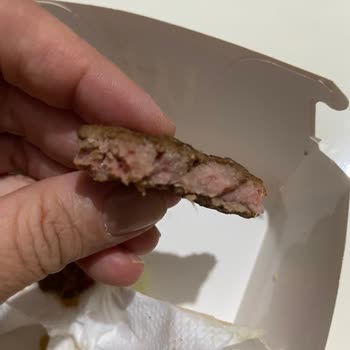 Çiğ Hamburger Ve Çocuk Sağlığına Tehdit