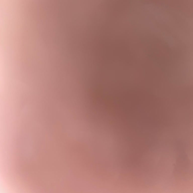 Destek Ve İletişim Eksikliği