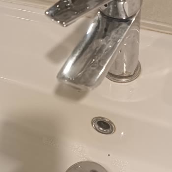 Ankara Etlik Şehir Hastanesi Hijyen Ve Personel İlgisizliği Sorunu!