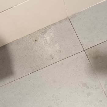 Ankara Etlik Şehir Hastanesi Hijyen Ve Personel İlgisizliği Sorunu!