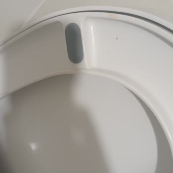 Ankara Etlik Şehir Hastanesi Hijyen Ve Personel İlgisizliği Sorunu!