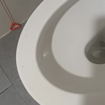 Ankara Etlik Şehir Hastanesi Hijyen Ve Personel İlgisizliği Sorunu!