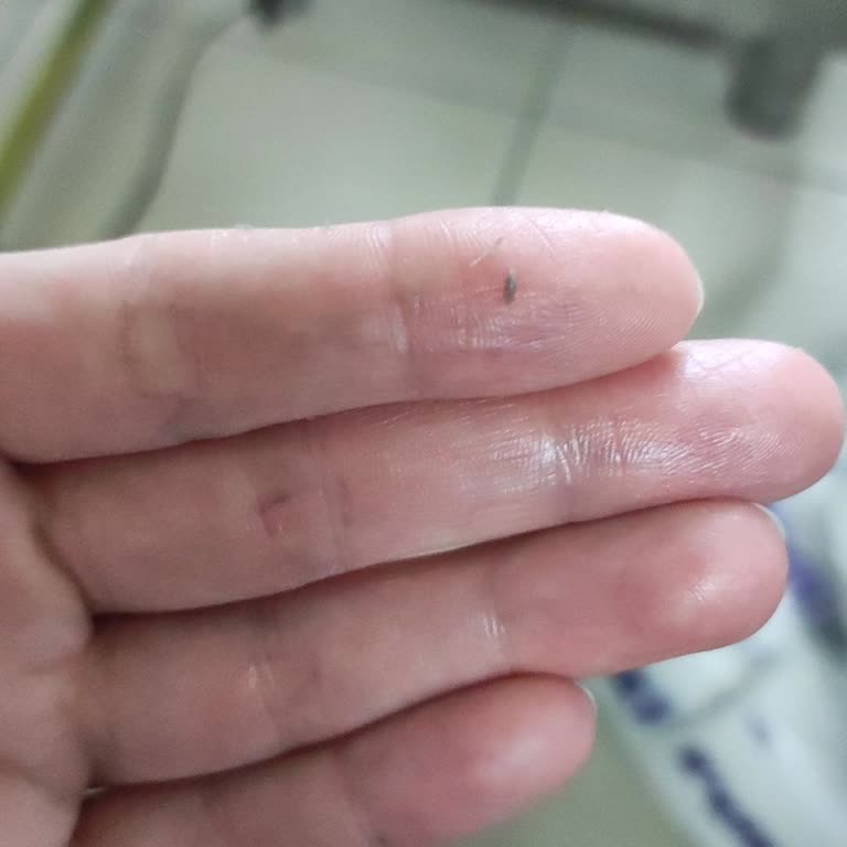 Yves Rocher Nemlendirici Kremde Beklenmedik Soyulma Sorunu