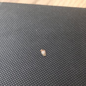 BİM'den Aldığım Mantıdan Çıkan Şaşırtıcı Madde