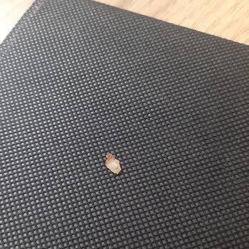 BİM'den Aldığım Mantıdan Çıkan Şaşırtıcı Madde