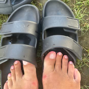 Ecco Sandals Caused Severe Blisters – Requesting Immediate Refund