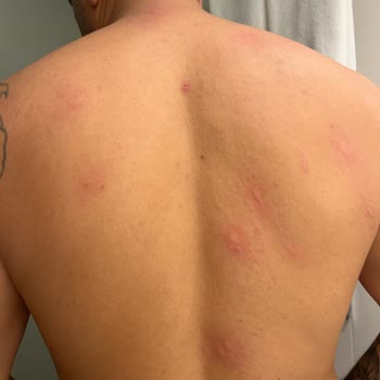 Hijyen Sorunları Ve İlgisizlik