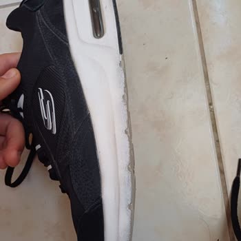 Skechers Ayakkabıda Renk Atması Ve Boyner'in Yetersiz Müşteri Hizmeti