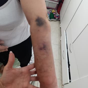 Yoğun Bakımda Belirsizlik Ve İlgisizlik