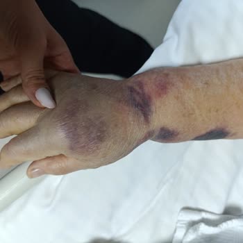 Yoğun Bakımda Belirsizlik Ve İlgisizlik