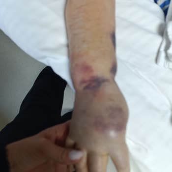 Yoğun Bakımda Belirsizlik Ve İlgisizlik