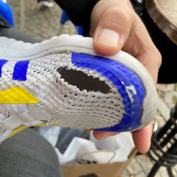 Adidas Ayakkabıda Üretim Hatası Ve Müşteri Hizmetleri Hayal Kırıklığı