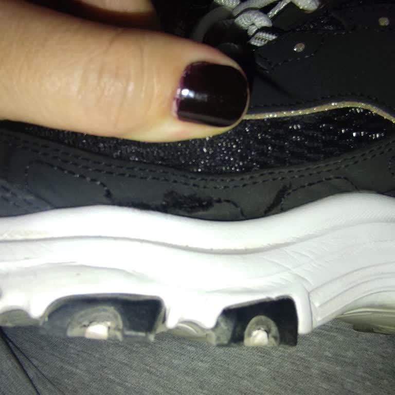 Skechers Ayakkabıda Dikiş Açılması Sorunu