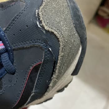 Skechers Ayakkabıda Beklenmedik Çatlak Ve Müşteri Hizmetleri Sorunu