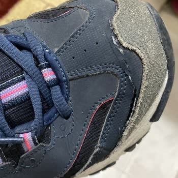 Skechers Ayakkabıda Beklenmedik Çatlak Ve Müşteri Hizmetleri Sorunu