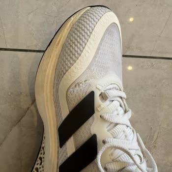 Adidas Ayakkabının Kalitesizliği Ve Müşteri Hizmetleri Hayal Kırıklığı