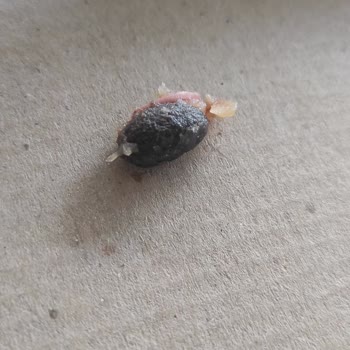 Soğuk Ve Dikkatsiz Pizza Servisi Diş Kırdı