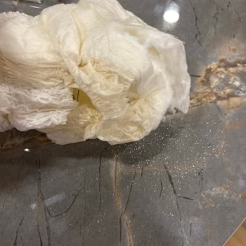 Külot Bezde Patlak: Yenidoğan İçin Hayal Kırıklığı