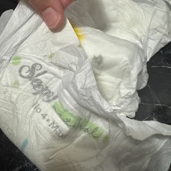 Bebek Bezinde Taş Parçası Şoku!