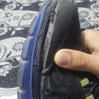 Trendyol'dan Aldığım Ayakkabıda Açılma Ve İade Sorunu