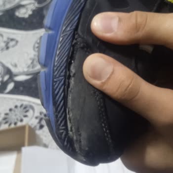 Trendyol'dan Aldığım Ayakkabıda Açılma Ve İade Sorunu