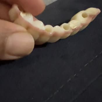 Özel Bağcılar Diş Sağlığı Şikayeti