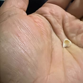 Özel Bağcılar Diş Sağlığı Şikayeti