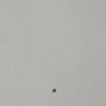 Pastada Metal Cisim: Diş Kıran Sipariş