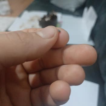 Pastada Metal Cisim: Diş Kıran Sipariş